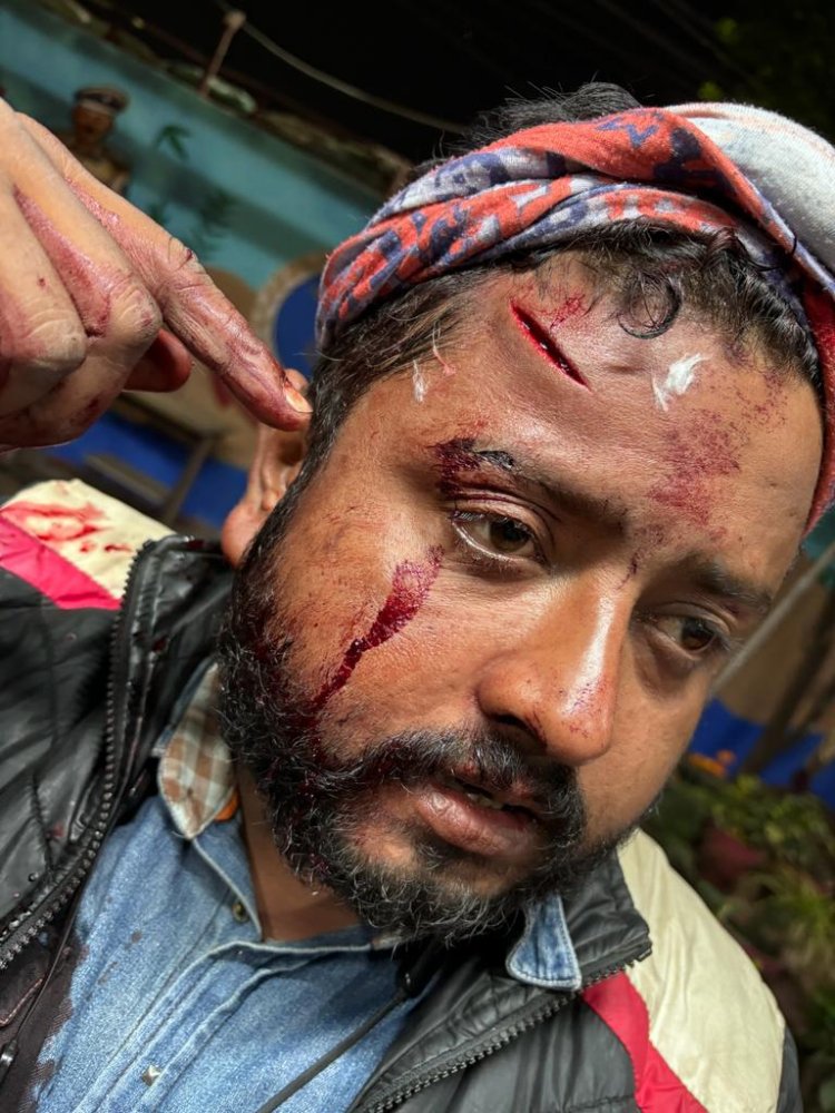 ସାମ୍ବାଦିକଙ୍କୁ ହତ୍ୟା ଉଦ୍ୟମ ରହସ୍ୟ... କର୍ପୋରେଟର ପୁଅ ମୁଖ୍ୟ ଚର୍ଚ୍ଚା  ପୁଲିସ୍ ଚାପଶୂନ୍ୟ ହେଲେ ସତ୍ୟାସତ ବାହାରିପାରିବ : Ommtv